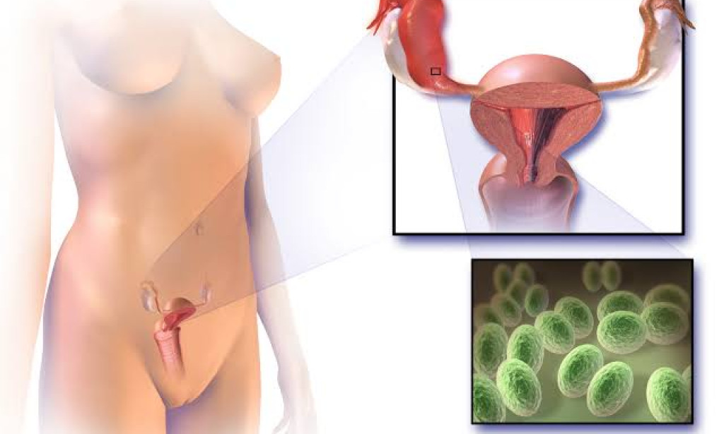 Understanding Sexually Transmitted Infections (STIs): Prevention, Diagnosis, and Treatment