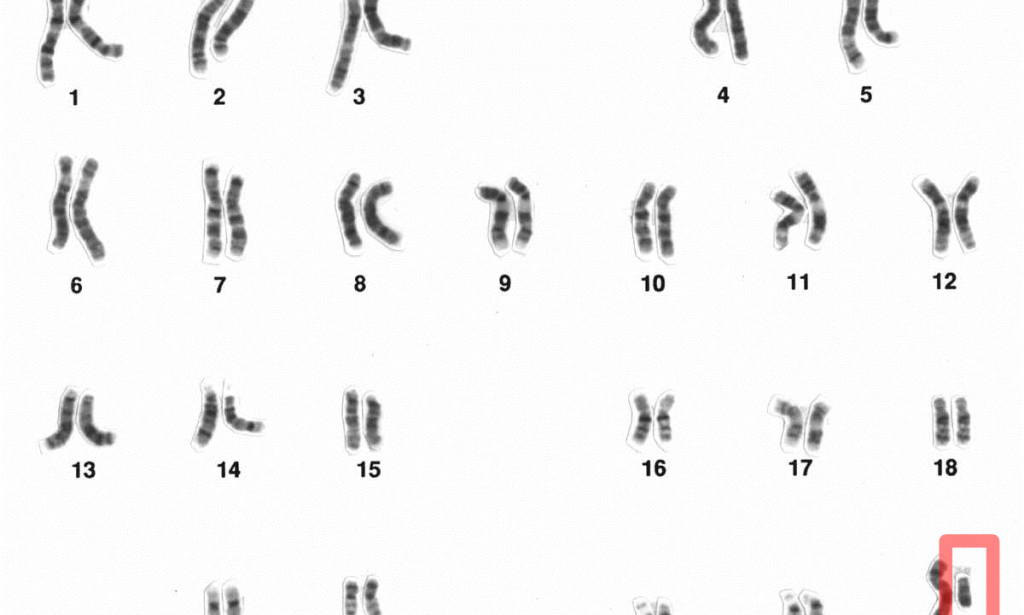 The scientific truth behind baby’s gender: Why women shouldn’t be blamed