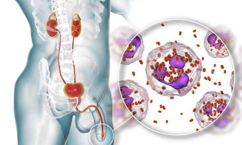 Super Gonaria: A Groundbreaking Discovery in the Fight Against Chronic Diseases