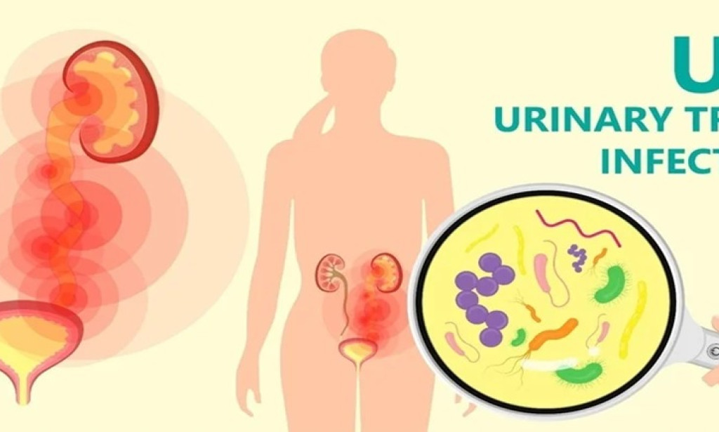The causes of a rise in UTI (Urinary Tract Infection) during cold seasons and how to  lower It